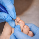 Pedicuría clínica en Buenos Aires Bazar